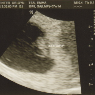 Oliver’s first ultrasound (7 weeks)